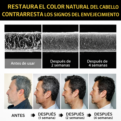 Black Hair Dye® - Shampoo Cubre Canas