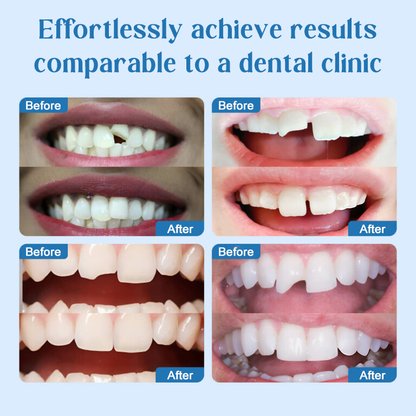 🦷Stop Hiding Your Teeth — Get a Perfect Smile in Minutes, No Dentist Needed🏠✨